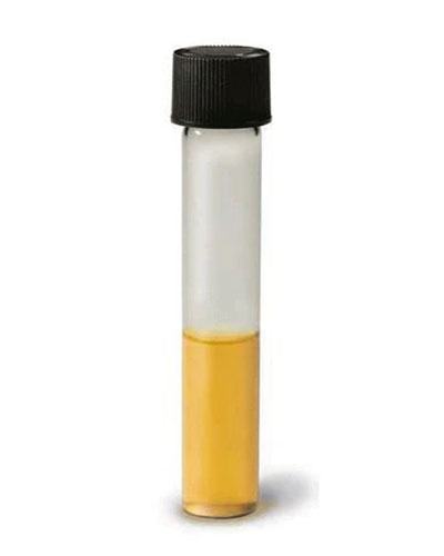 Môi trường nuôi cấy Soft Agar (thạch mềm)